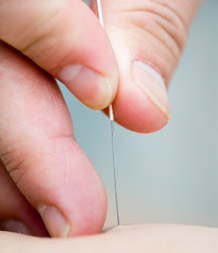 Acupuncture in Horsforth